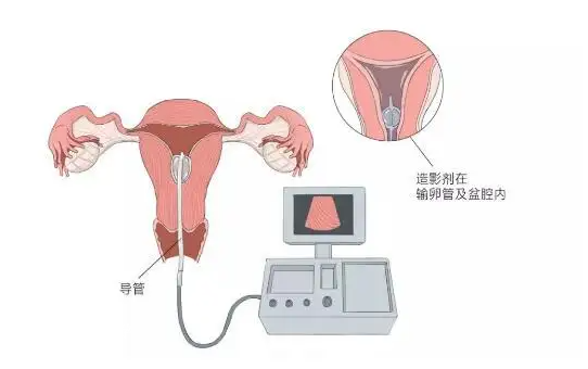 武汉康健医院试管婴儿三万是真的吗？和自然受孕一样吗？
